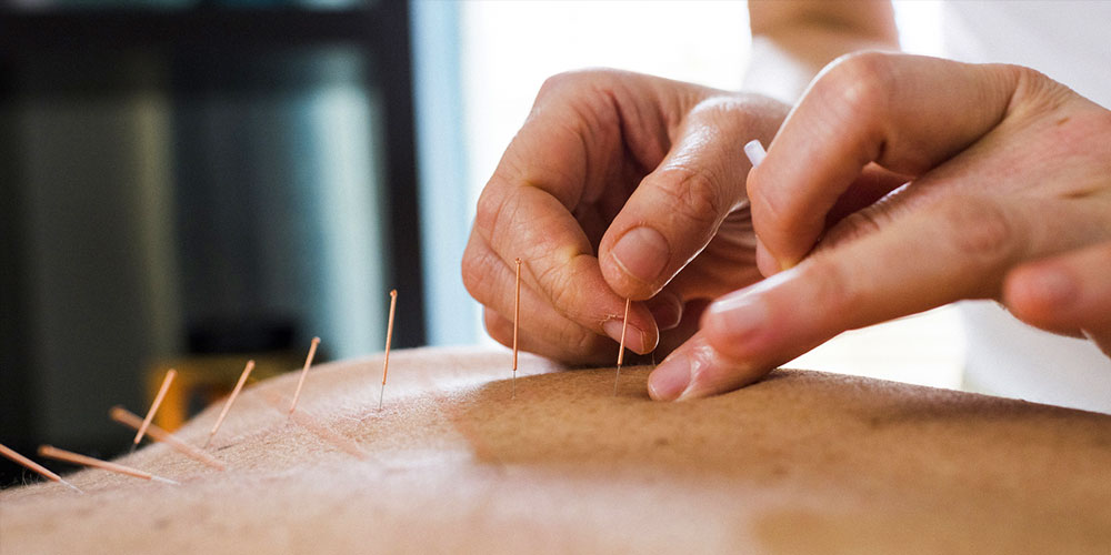 acupuncture treatment services hamilton
